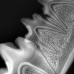Снимок дентального рентгена